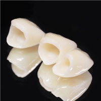 クラウン｜うめおか歯科