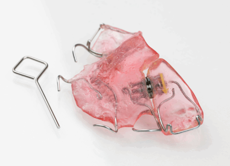 小児矯正と成人矯正の違い｜うめおか歯科