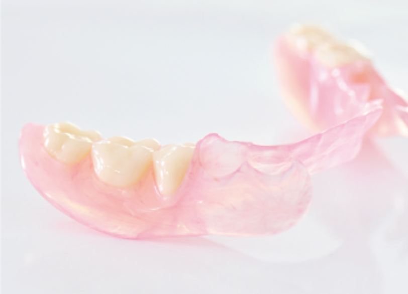 ノンクラスプデンチャー｜うめおか歯科