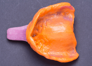 精密な型取り｜うめおか歯科