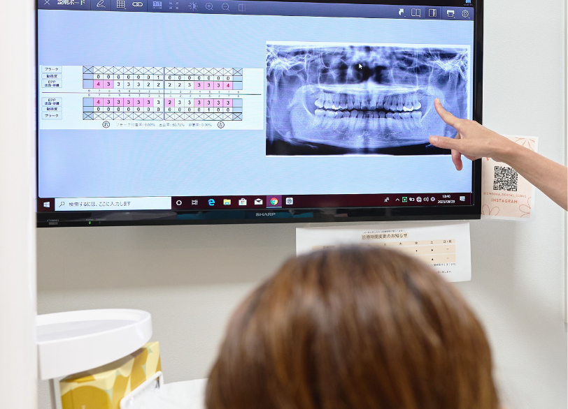 治療計画のご説明