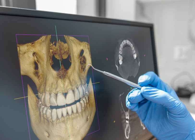 一人ひとりのお口に合わせた治療計画｜うめおか歯科