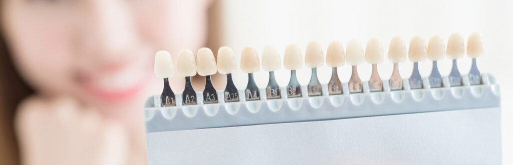 自信が持てる白い歯｜うめおか歯科