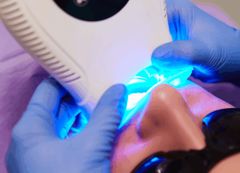 オフィスホワイトニング｜うめおか歯科